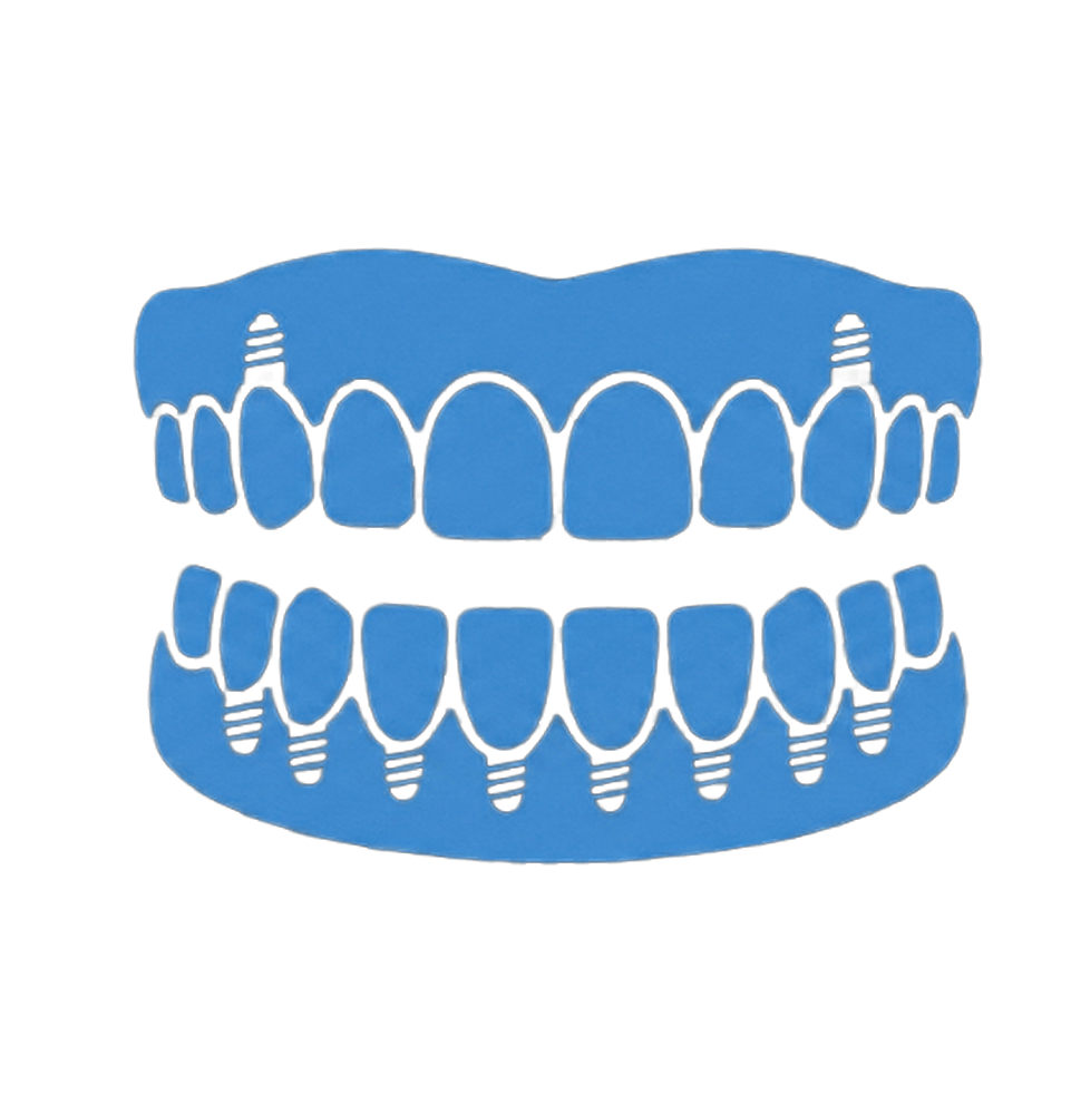 icon of full arch dental implant
