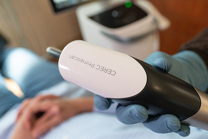 CEREC Primescan dental technology