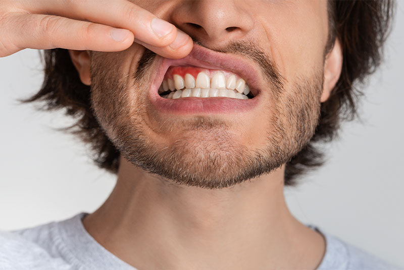 Gum disease