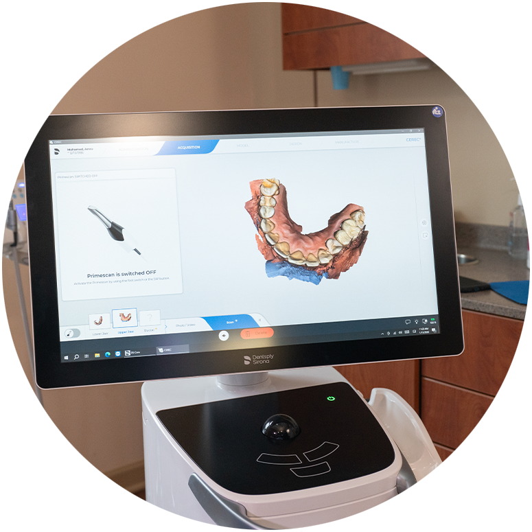 3d scan of Patients mouth