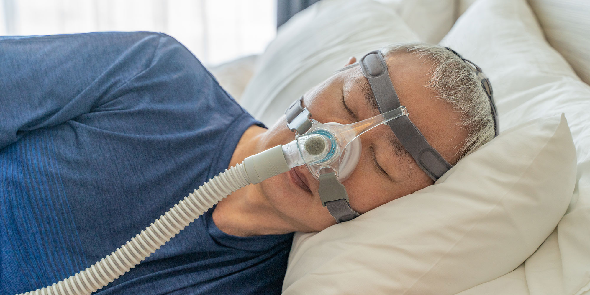 Sleep apnea
